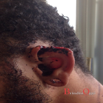 ferite orecchio francavilla